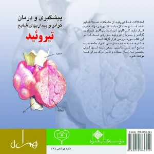 پیشگیری و درمان گواتر و بیماریهای شایع تیروئید